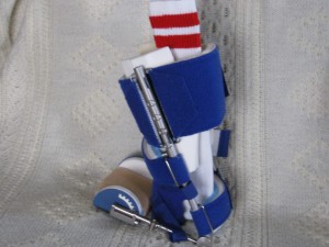 My Odd Sock's Dynasplint System