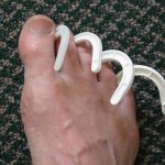 Hook Toe  (Is that nail fungus?)